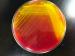 Mannitol Salt Agar (MSA) plate used for identifying Staphylococci