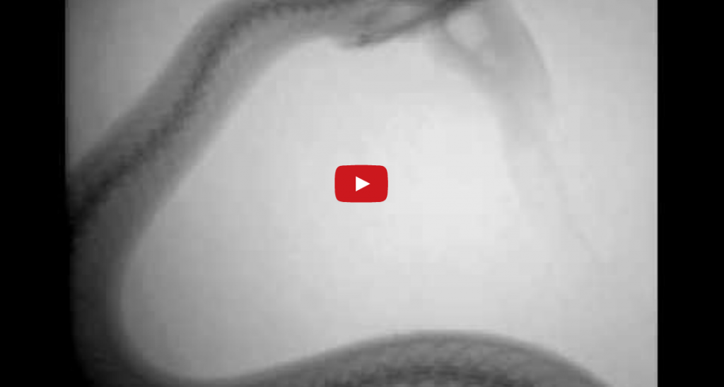 X-ray of a watersnake eating a fish