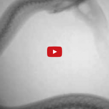 X-ray of a watersnake eating a fish